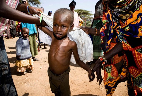 A colour image of a young malnourished boy East Africa Appeal supported by The Ellis Campbell Foundation